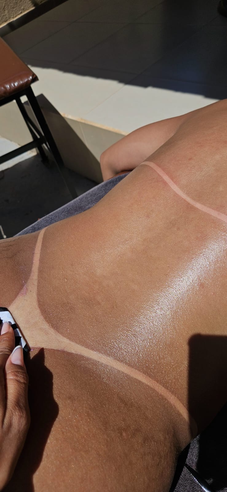 Marquinha uniforme nas costas após sessão de bronze.